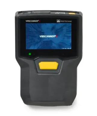 VIBSCANNER 2